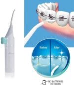 Dental Water Flosser - Image 6