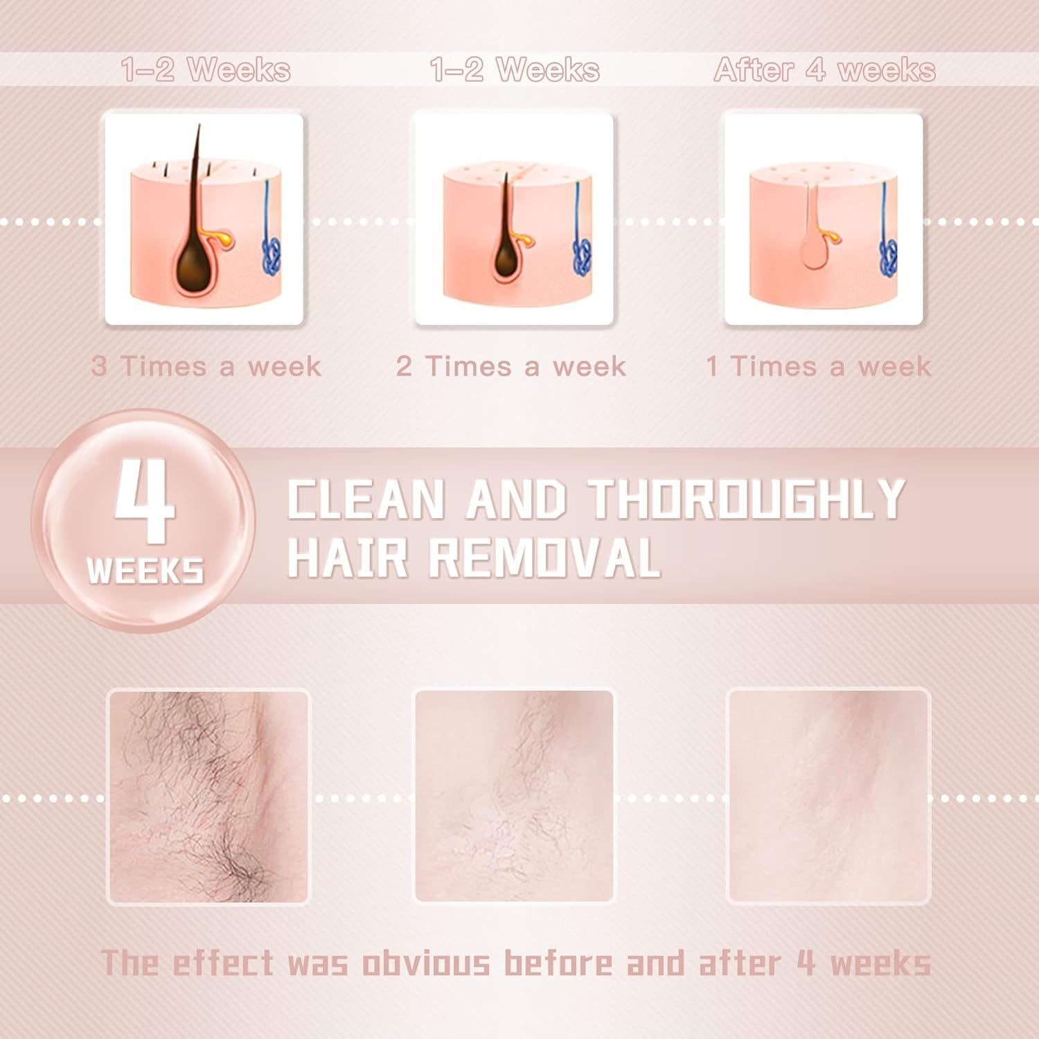 IPL Laser Hair Removal Device for Women and Men - Image 3